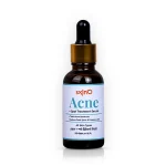 skin'O Acne + Spot Treatment Serum 30ml – Oil Control & Dark Spot Care for Clear Skin